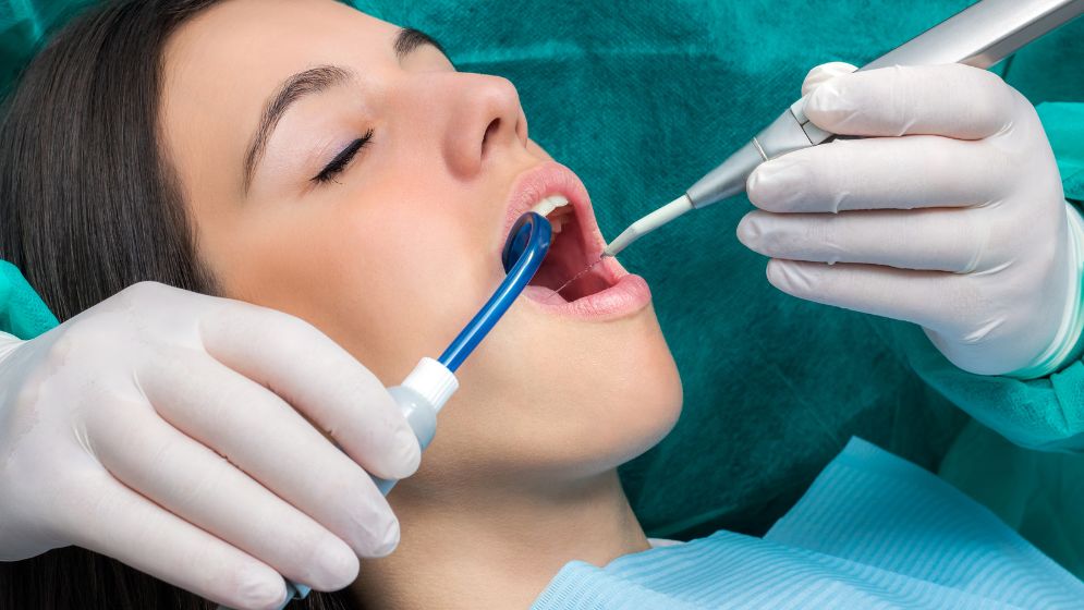 Bước 8 của quy trình bọc răng sứ tại Nha khoa Tracy