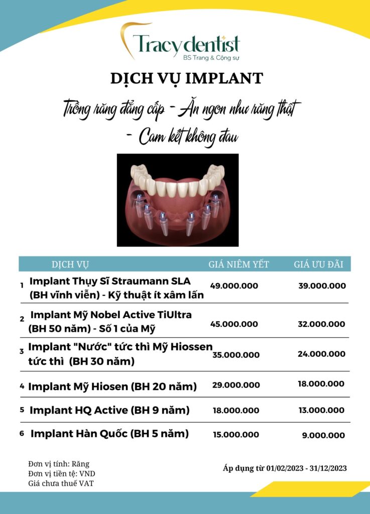 Bảng giá dịch vụ trồng răng implant tại Tracy Dentist