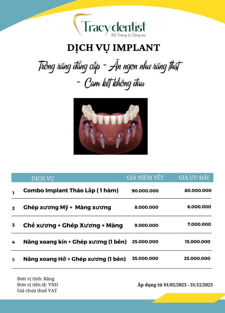 Bảng giá dịch vụ trồng răng implant tại Tracy Dentist