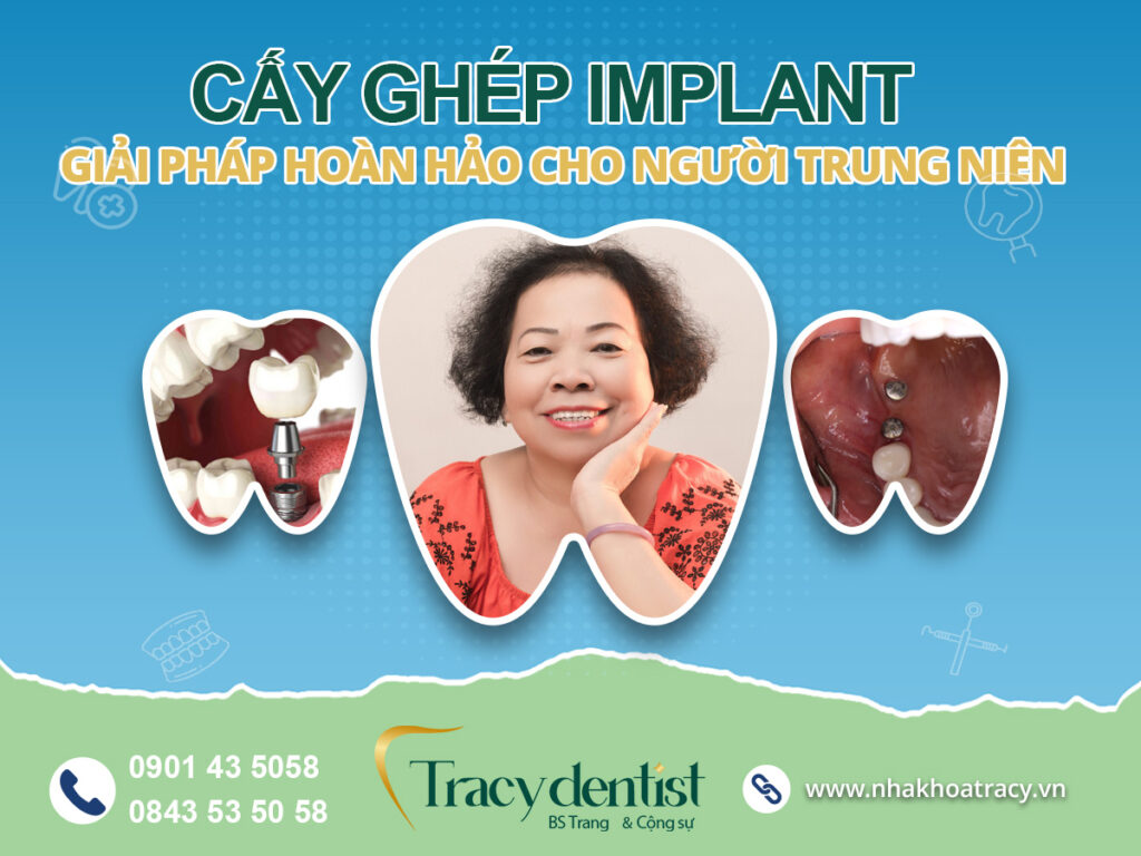 Dịch vụ cấy ghép implant tại Nha Khoa Tracy