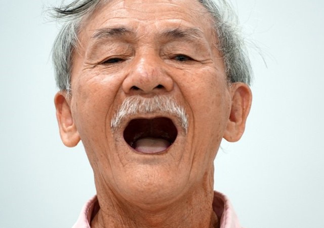 Người cao tuổi bị mất hết răng
