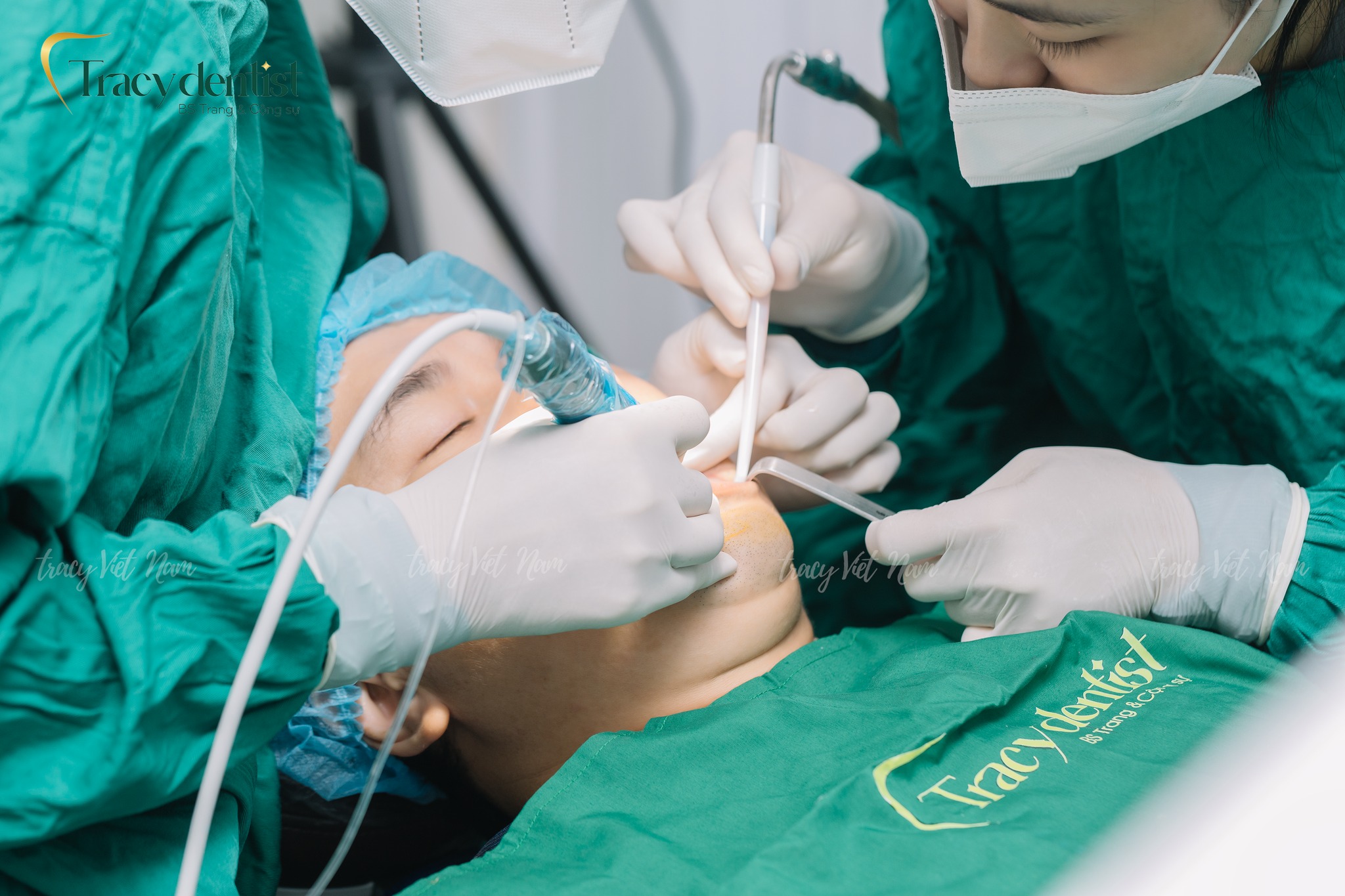Quy trình trám răng được thực hiện cẩn thận tại Tracy Việt Nam 