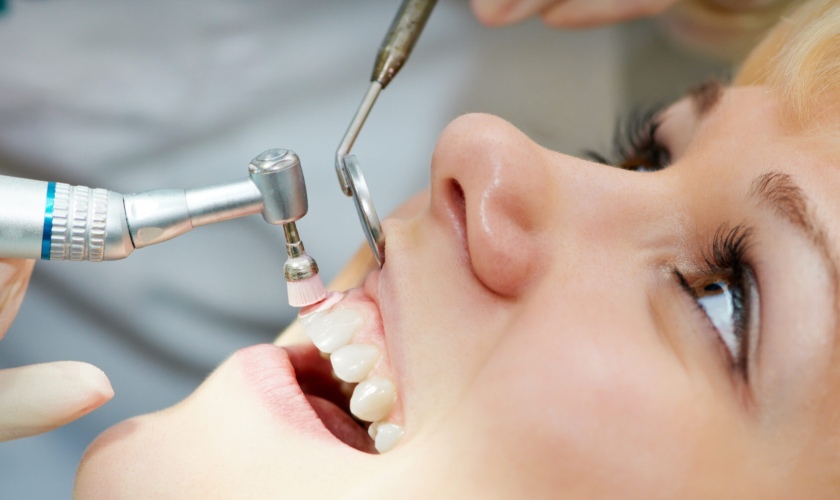 Đánh bóng răng tại Nha Khoa Tracy 