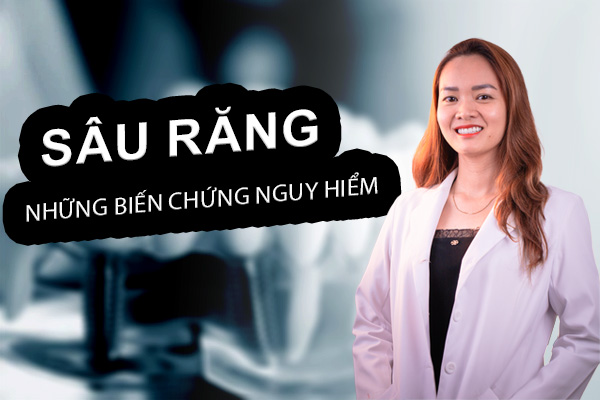 Sâu răng và những biến chứng nguy hiểm